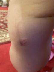 Dog bite or scratch?