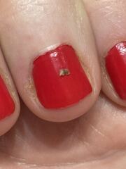 Beautiful lump from DPs neck…!