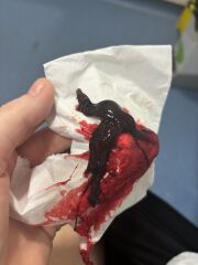 How to get a dr to take me seriously includes graphic pictures