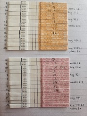Recurrent Chemical Pregnancies