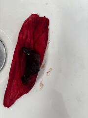 How to get a dr to take me seriously includes graphic pictures