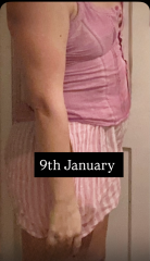 December 25 starters thread?