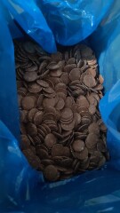 Retroperitoneal Leiomyosarcoma part 2