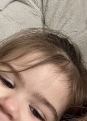 Does my child have childhood dementia