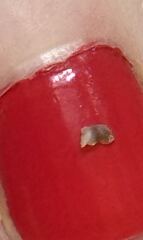 Beautiful lump from DPs neck…!