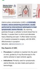 Large fibroid… what now?