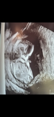 Nub Theory Guesses? 13w