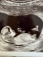 Any nub guesses?