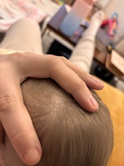 Baby has extremely dry scalp , what to use ?