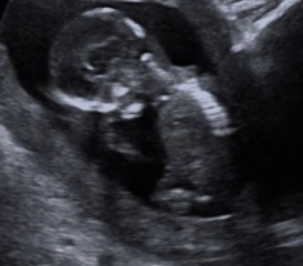 Boy or girl based on skull