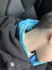 Anyone else have experience with visible lymph node in child?