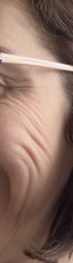 Thinking my wrinkles are excessive?