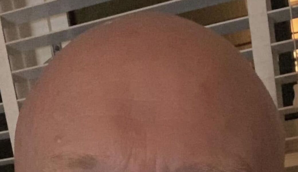 Do some people genuinely not notice their own lines and wrinkles?