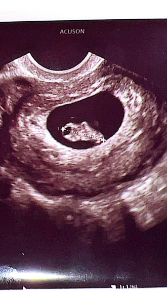 Predict my baby’s gender?