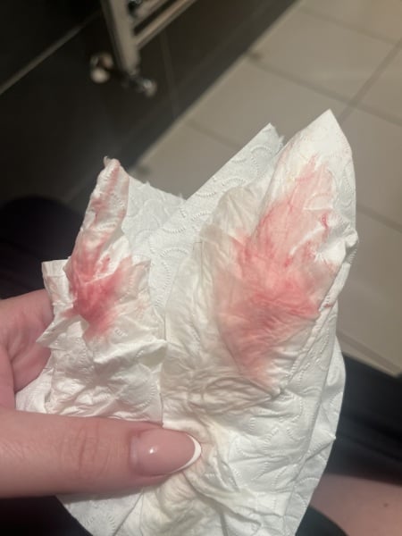Bleeding at four weeks pregnant, is this normal?