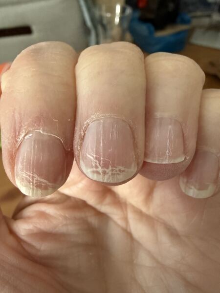 Nails