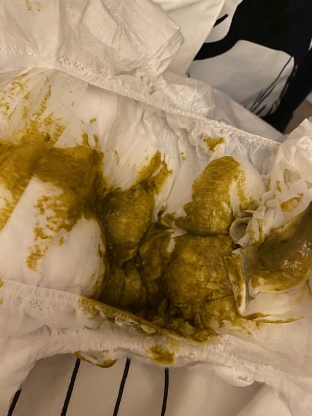 Is my 3 month old baby poo normal (exclusively breastfed)