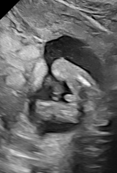 Boy or girl? 16 week potty shot