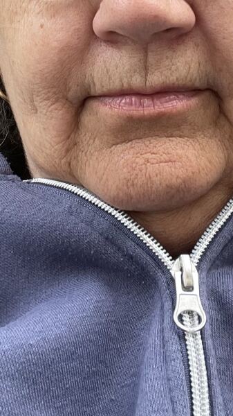 Do some people genuinely not notice their own lines and wrinkles?