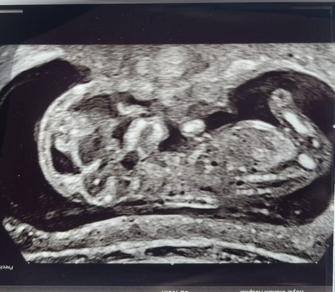 Boy or girl ?💙💗