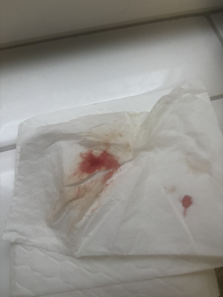 How concerned should I be about bright red blood after a poo?
