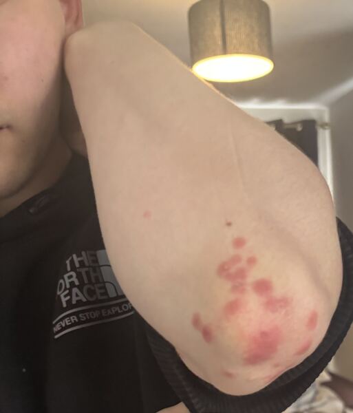 Anyone know what this is on my son