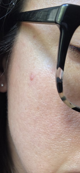 Are there any dermatologists here that can help please?