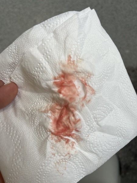 Implantation bleeding or period?