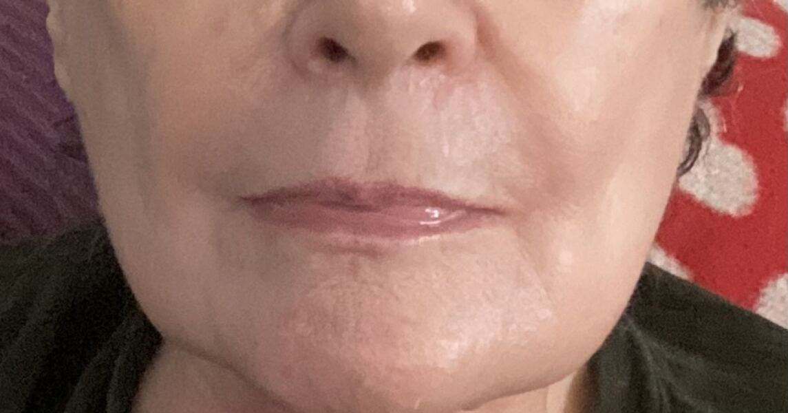 Do some people genuinely not notice their own lines and wrinkles?