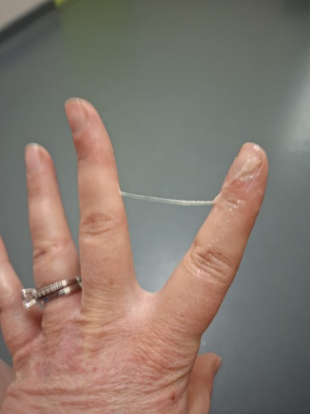 Photo attached. Is this cm before or post ovulation?