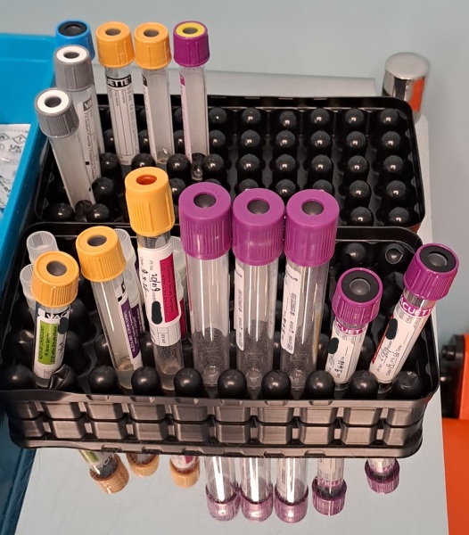It wasn't ovarian, it was lymphoma