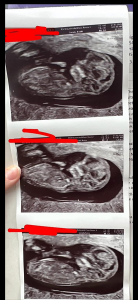 Any guesses on baby's sex from our 12 week scan? 🩷🩵💛