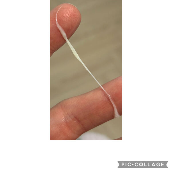 Is this fertile cervical mucus or early pregnancy discharge ?