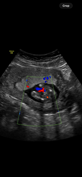 16-week scan: does this look like a boy to others?