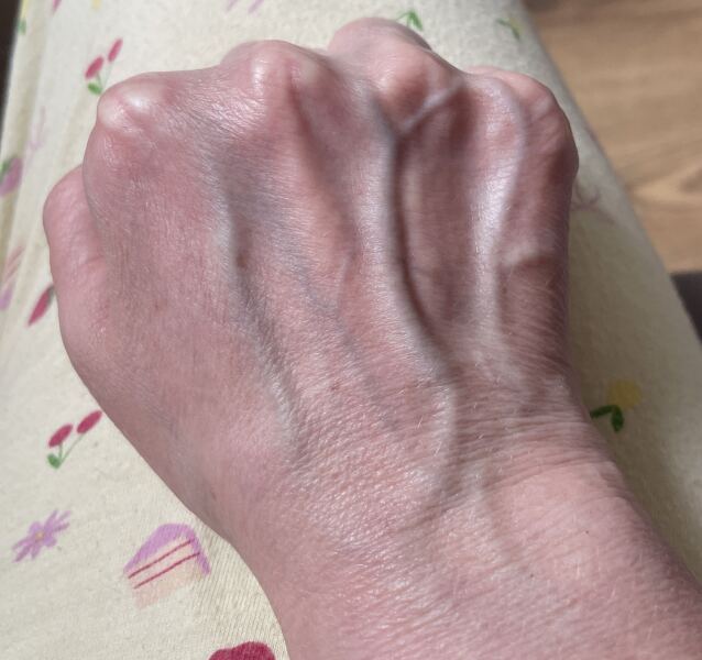 My hands age me!