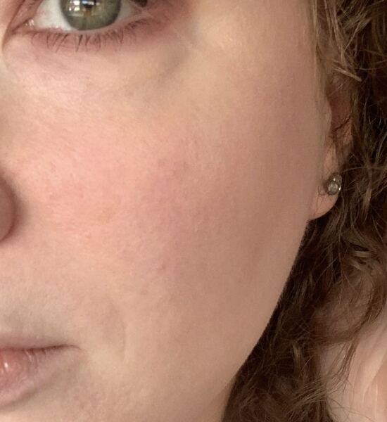 Do some people genuinely not notice their own lines and wrinkles?