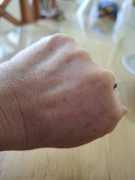 My hands age me!