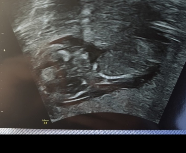 Just for fun, boy or girl guesses for this pregnancy?