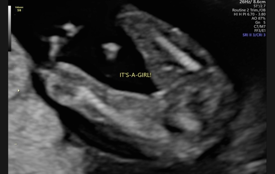 To not want my partner to be an anonymous sperm donor?