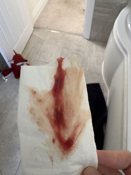 Attending triage too much? *trigger warning pictures*