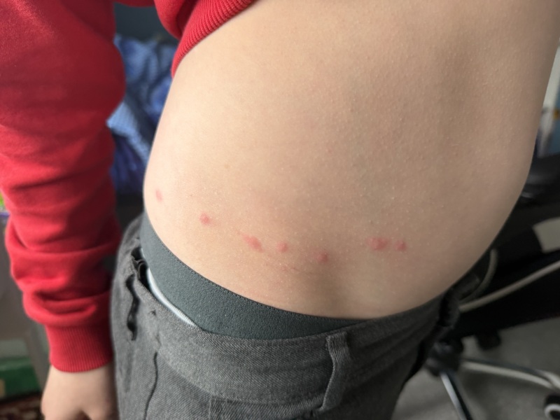 Row of spots on waist