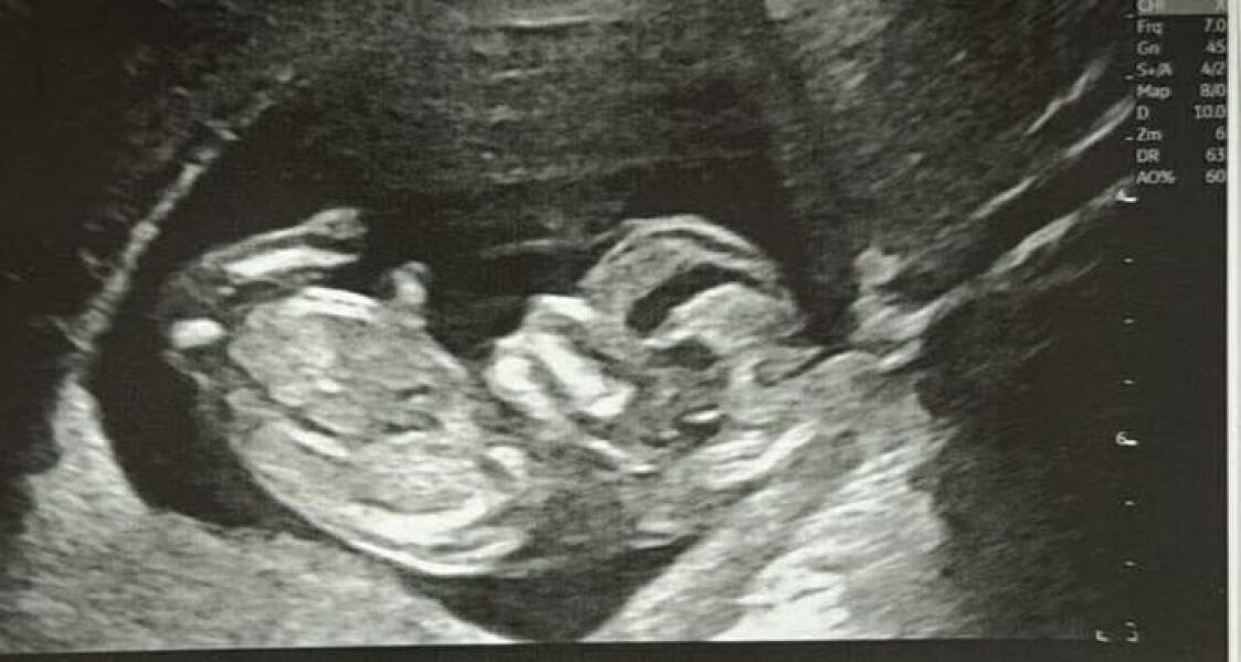 Any guesses on sex?