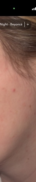 Are there any dermatologists here that can help please?