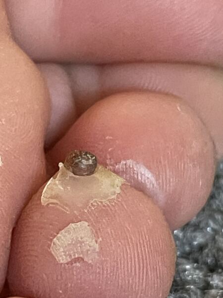 Anyone seen this before? 🤢