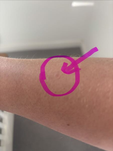 Weird skin mark