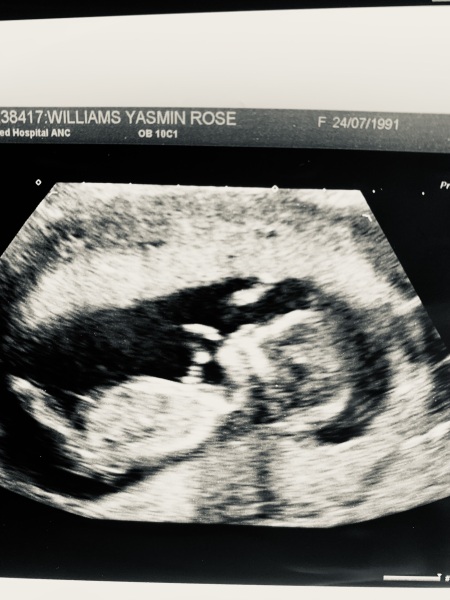 Can anyone give a second opinion on this pregnancy scan image?