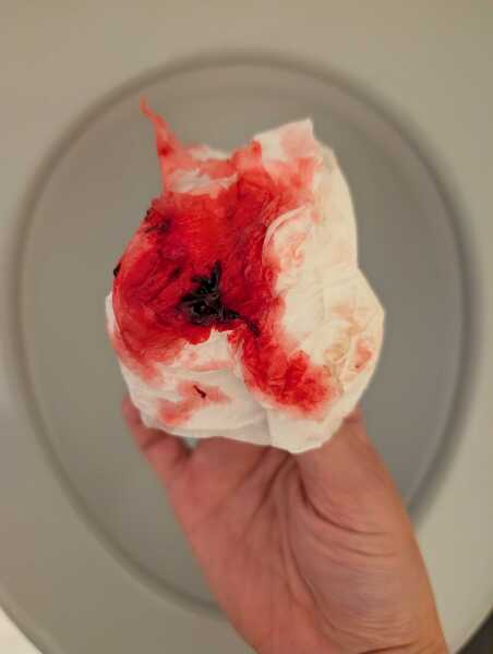 Graphic photo*******