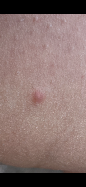 Should I be concerned?