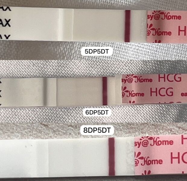 6th loss - this time of a confirmed euploid
