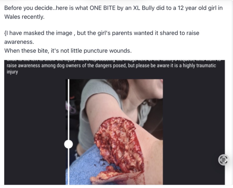 Another child killed by a dog...